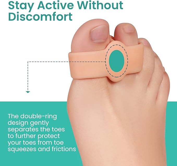 Welnove Pack of 12 Bunion Corrector, Toe Separators with 2 Loops, Big Toe Spacer Suitable for Bunion and Overlap Toe (Beige)