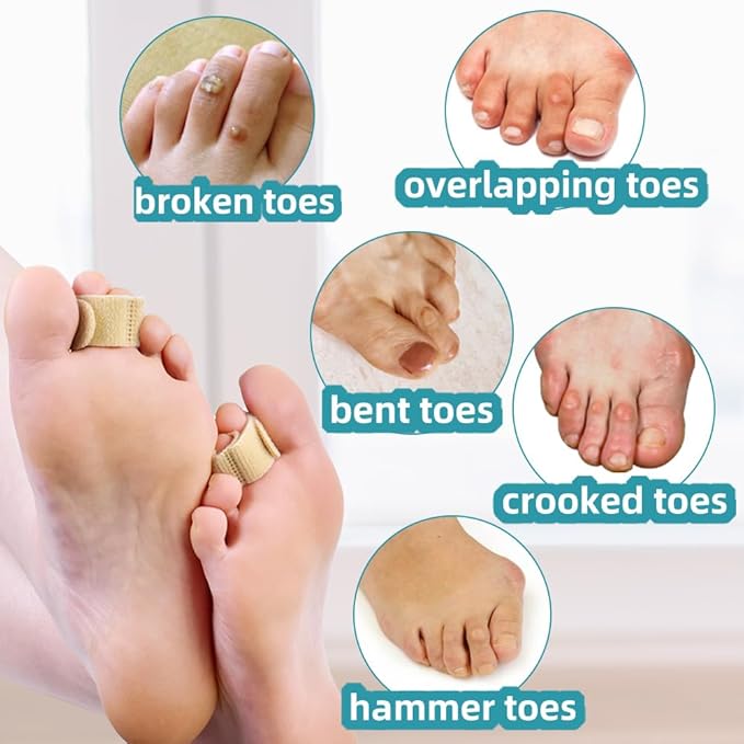 Medical-all Toe Separators for Overlapping Toes, Bunions, Big Toe Alignment, Corrector and Spacer, Reusable Fabric Buddy Wraps for Broken Toes, Hammertoe Straightener (BEIGE)