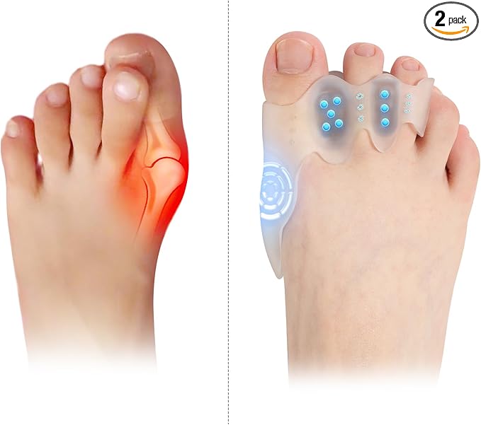 Toe Spacers & Bunion Corrector for Men&Women|Toe Separators,Corn Callus Removers|Hammer Toe Straightener|Bunion Relief|Overlapping Toes Separators|Corn Pads for Toes|1 Pair (Large)