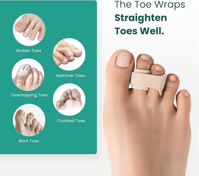 Welnove Hammer Toe Straightener - 8 Pack Broken Toe Wraps - Hammer Toe Corrector for Women - Toe Splints for Crooked Toes, Curled Toes, Bent Toes - (Small, Beige)