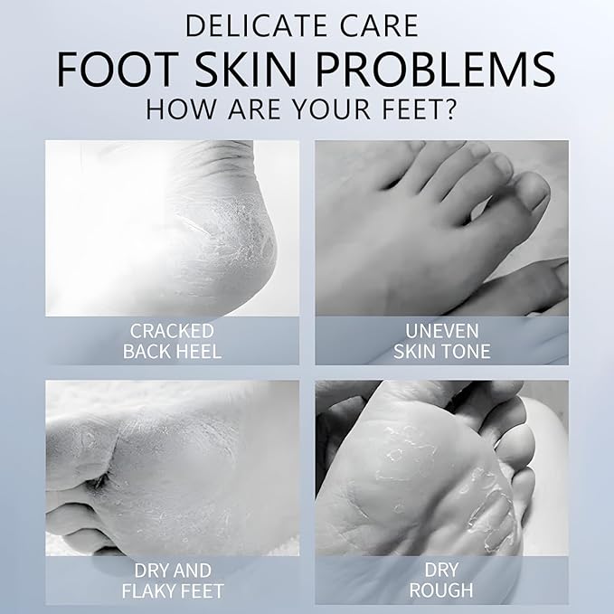 Foot Masks Moisturizing Socks - Moisturizes Tired, Dry & Cracked Feet, Exfoliating Hydrating Foot Mask - Dry Skin Solution - Moisturizing Foot Treatment- All Skin Types - 11Pairs