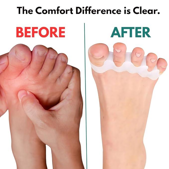 6 Pcs Silicone Toe Separators & Toe Spacers for Men & Women Gel Toe Separators for Overlapping Toes Bunions & Bent Toes Toe Spreader & Toe Stretcher for Alignment, Pain Relief Balance & Relaxation