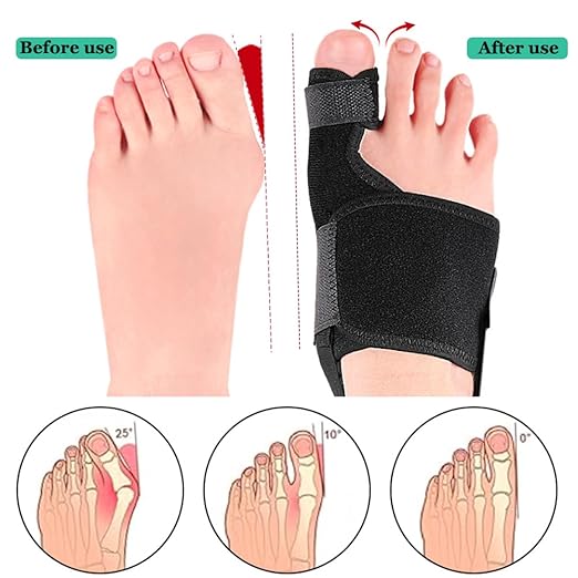 Bunion Toe Corrector Splint for Women & Men, Adjustable Bunion Straightener for Pain Relief, Big Toe Orthopedic Separator for Hallux Valgus, Hammer Toe, Day/Night Support (Left Foot)