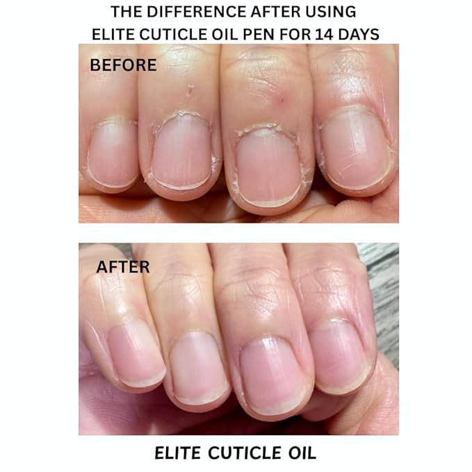 Elite Cuticle Oil Pen (Peach) – Hydrating Nail & Cuticle Oil with Jojoba Oil & Vitamin E – Sweet Scented Nail Care Treatment (3ML)