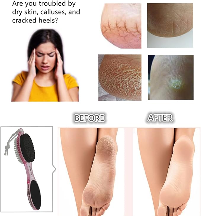 Foot File Callus Remover 4-in-1, Feet Scraper Pedicure Tools with Pumice Stone, Foot Scrubber Brush, Foot Rasp and Sand Paper, Double Sided Multi Purpose for Home Foot Care, Clear Pink