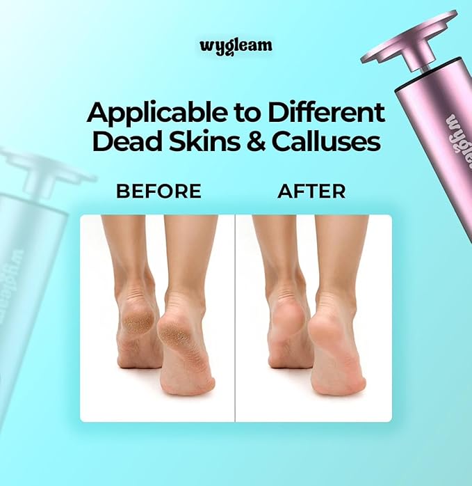 2-in-1 Electric Callus Remover and Nail File Drill Kit for Flawless Feet & Nails - 3 Speeds, Rechargeable, Professional at-Home Pedicure & Manicure Tool