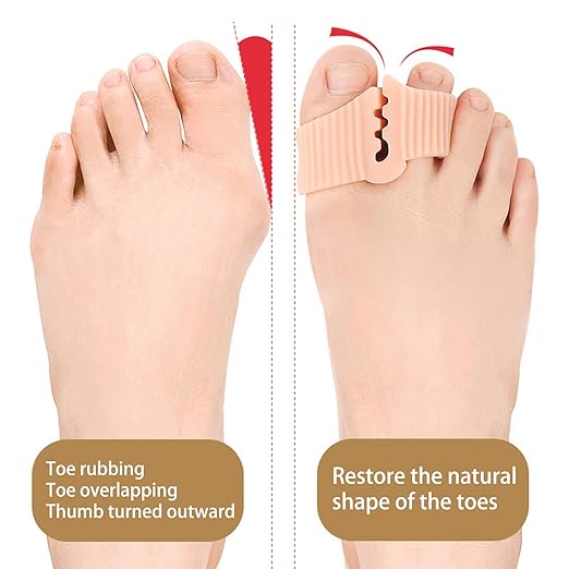 8 Pack Gel Toe Separators, Soft Breathable Big Toe Corrector with Gel Toe Spacer Cushion, Bunion Toe Separators for Bunion Corrector and Overlapping Toes Women Men, Specially Used For Flip Flops