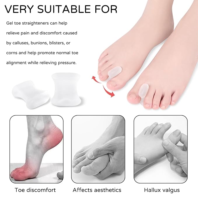 Gel Toe Separators,For Crooked Toes, Overlapping Toes, Hammertoe Corrector,For Women Men Toe Pain Relief(8 Pcs)