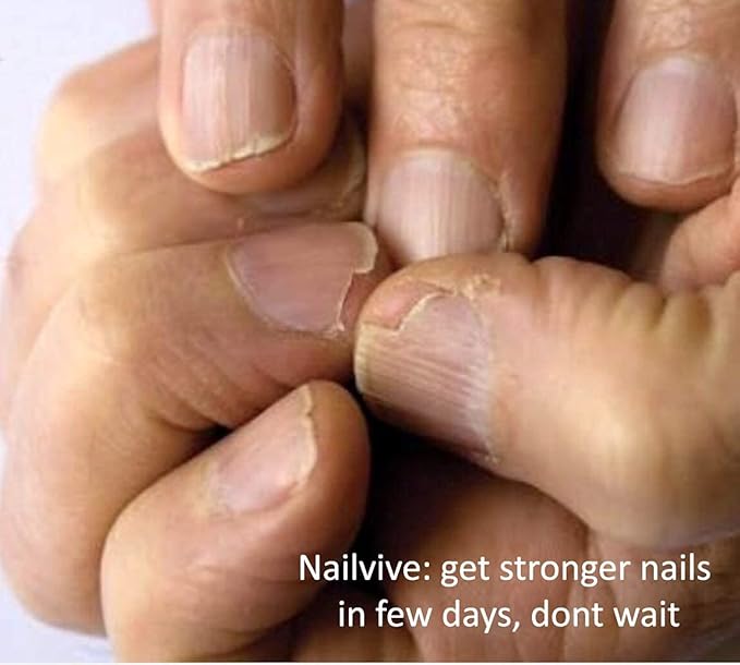 NAILVIVE Nail Serum Natural Keratin Nail Treatment Silk Proteins Proven Natural Formula Strengthening Hardening nails Instantly Prevents Splits Chips Peels Cracks on Your Nails