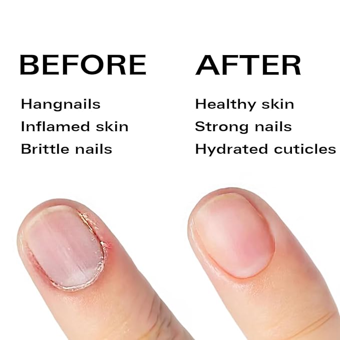 Nail Oil Cuticle Pen - Jasmine - Nail Strengthener & Growth Serum with Vitamin A, D, E, B5, Grapeseed & Natural Oils - Repair for Brittle, Peeling, Thin Nails - Twist Brush Pen
