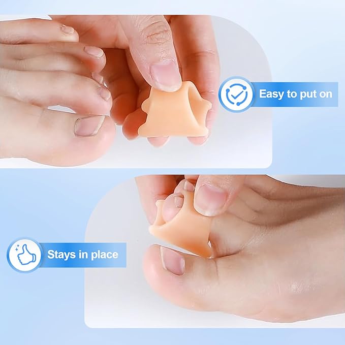Hammer Toe Corrector, 6 Pack Toe Spacers, Toe Straighteners for Curled Toes, Bunion Corrector for Preventing Rubbing & Relieve Pressure (Medium)