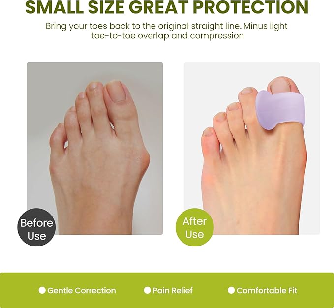 Bukihome Toe Separator for Overlapping Toes - 6 Pack Toe Spacers for Bunions with Lavender Extract - Toe Corrector for Hammer Toes, Realign Crooked Toes (Multi-Size, Lavender)