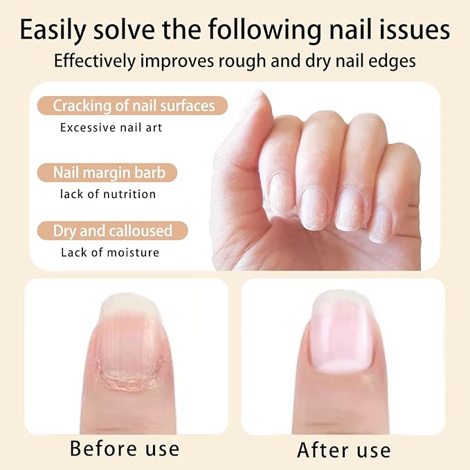 AIJIMEI Nail Oil Cuticle Pen 2pcs Nail Cuticle Oils Pens Are Nail Strengthening Agents And Nail Growth Essence, Suitable For Fragile Peeling And Broken Thin Nails（Rose & Cherry）.