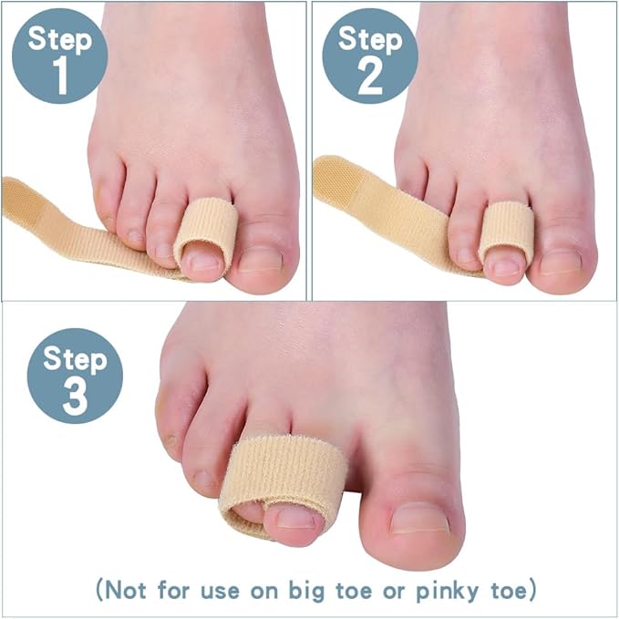 Medical-all Toe Separators for Overlapping Toes, Bunions, Big Toe Alignment, Corrector and Spacer, Reusable Fabric Buddy Wraps for Broken Toes, Hammertoe Straightener (BEIGE)