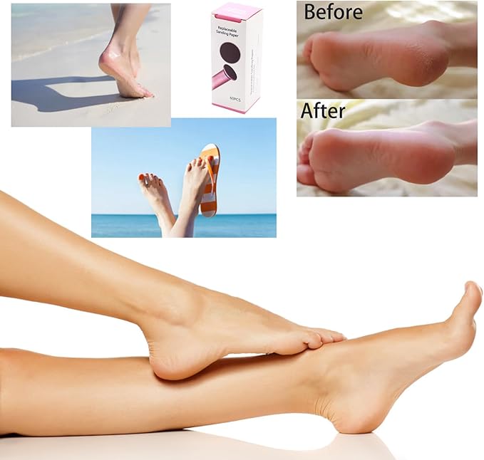 Electric Feet Callus Remover Gold Professional Powerful Foot File Pedicure Grinder Sanders with 60PCS Replacement Sandpaper Discs Heel Scraper for Dead Dry Crack Skin Calluses Speed Adjustable