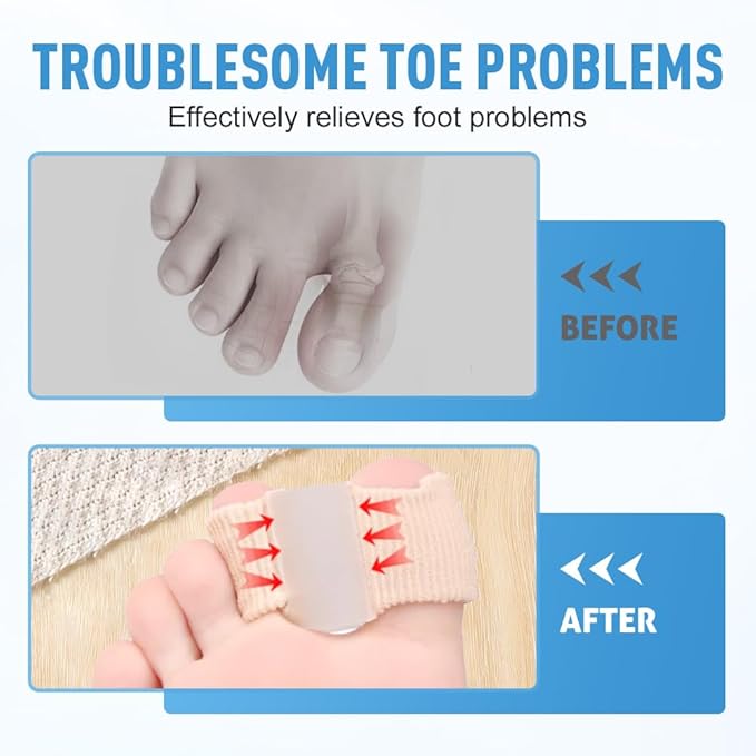 Toe Separators for Overlapping Toes, 2025 New Multifunctional Gel Toe Spacers Corrector with 2 Loops, PremiumToe Straightener for Women and Men Foot Care Tool (12 Pcs, L)