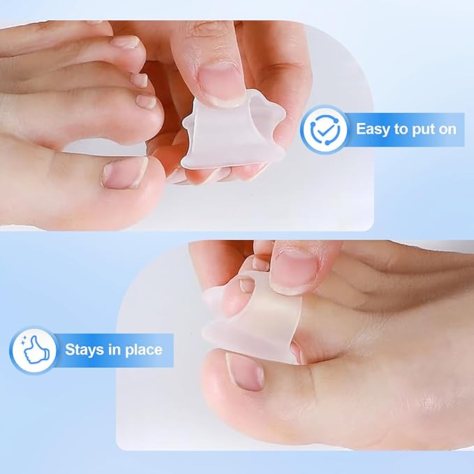 Hammer Toe Corrector, 6 Pack Toe Spacers, Toe Straighteners for Curled Toes, Bunion Corrector for Preventing Rubbing & Relieve Pressure (Medium)