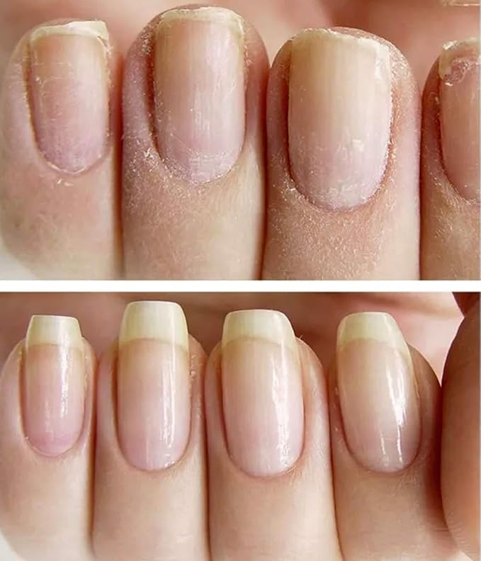 NAILVIVE Nail Serum Powerful Magic-like Silk Proteins Proven Natural Formula Strengthening Hardening nails Instantly Prevents Splits Chips Peels Cracks on Your Nails (BOTTLE APPLICATOR)