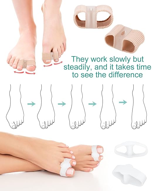 4Pcs Toe Separators Bunion Corrector for Women Men, Gel Big Toe Spacers with 2 Loops for Feet, Hammer Toe Straightener, Elasticity and Soft (2Nylon+2Gel)
