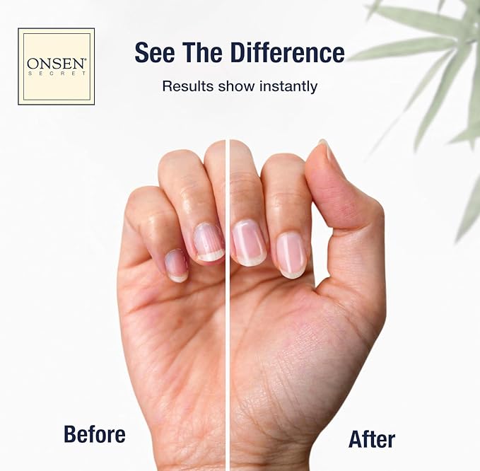 Onsen Nail & Cuticle Cream Treatment w/Japanese Tsubaki, Jojoba & Lavender Oil, Shea Butter - Strengthens Nails, Softens Cuticles - Daily Repair Care (1 Count/30 ml)
