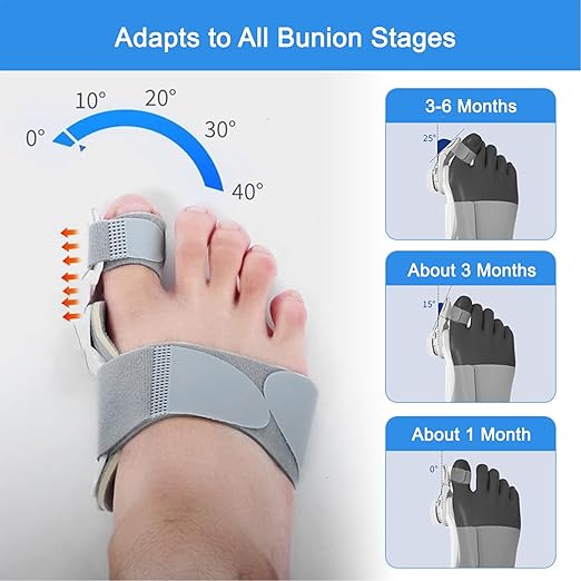 Upgraded Bunion Corrector for Women & Men, Orthopedic Bunions Correction with Non Slip Big Toe Separators, Adjustable Bunion Splint Suitable for Left/Right Foot Bunion Relief