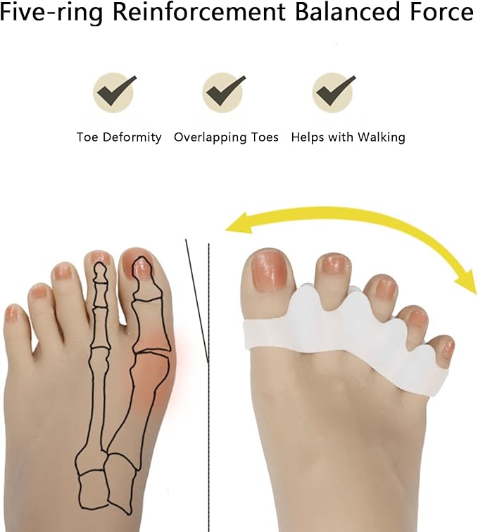 Kingjie Silicone Toe Spreaders for Men & Women - Correct Curled Toes, Bunion & Hammer Toe Support, Reusable & Washable Adjustable Unisex Toe Spacer（4 Pack） (White + Skin Color)