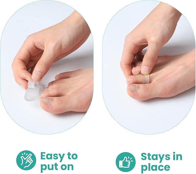 Welnove Hammer Toe Straightener Toe Corrector for Women - 8 Pcs Hammer Toe Cushion Pads for Bent, Crooked, Curled, Claw, and Hammer Toes - Soft Support and Realignment(Clear, One Loop Design)
