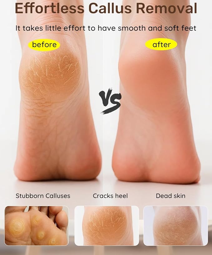 2 Sided Crystal Hair Eraser & Glass Foot File Callus Remover for Woman 2 in 1 - Natural Bamboo Crystal Hair Remover,Nano Glass Foot Scraper Scrubber Dead Skin Removal for Cracked Heels