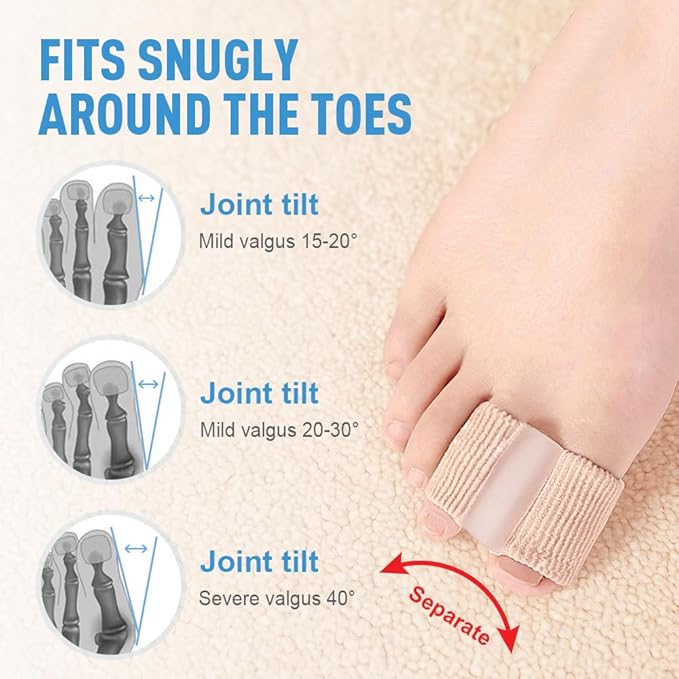 Toe Separators for Overlapping Toes, 2025 New Multifunctional Gel Toe Spacers Corrector with 2 Loops, PremiumToe Straightener for Women and Men Foot Care Tool (8 Pcs, S)