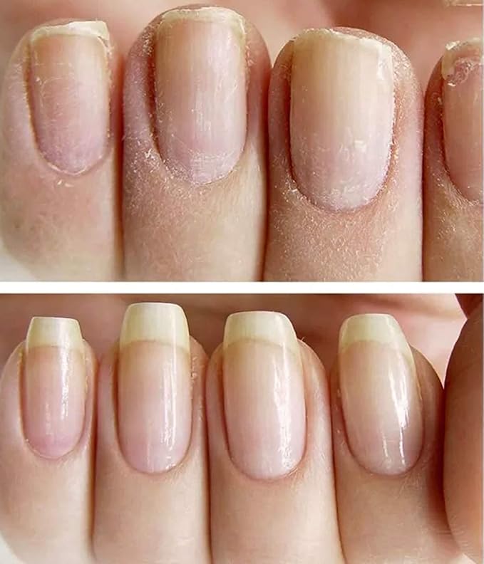 NAILVIVE Nail Serum Natural Keratin Nail Treatment Silk Proteins Proven Natural Formula Strengthening Hardening nails Instantly Prevents Splits Chips Peels Cracks on Your Nails