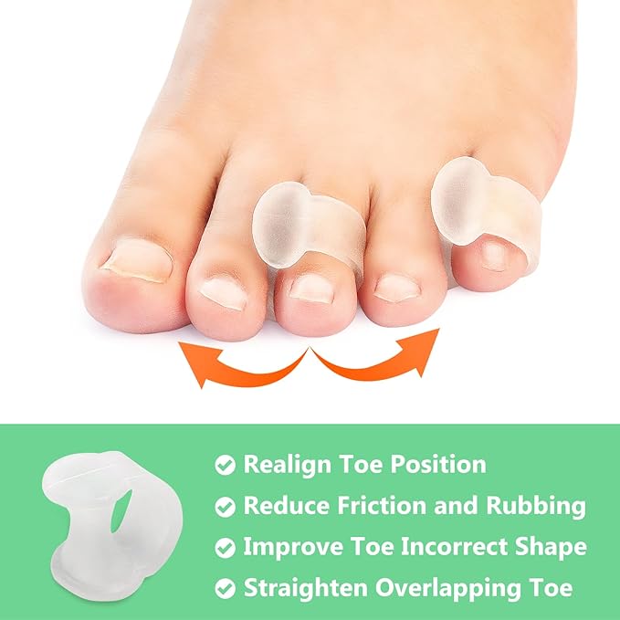 Niupiour Silicone Toe Separator - 14 Pack Gel Toe Spacers for for Women and Men, Toe Corrector for Women and Men, Toe Straightener for Bunions, Overlapping Toe, Hammer Toe, Say Goodbye to Pain