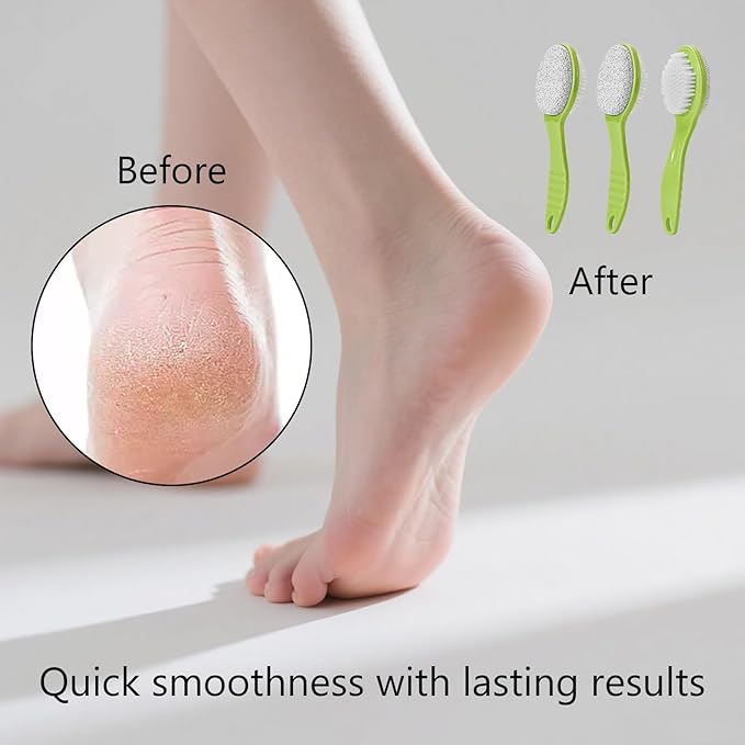 Foot Callus Remover, Double-Sided Pumice Stone Brush for Feet, 3 Pack Foot File Scrubber for Home Feet Care, Multi Purpose Pedicure Tools with Handle for Dead Skin Remover in Shower, Green