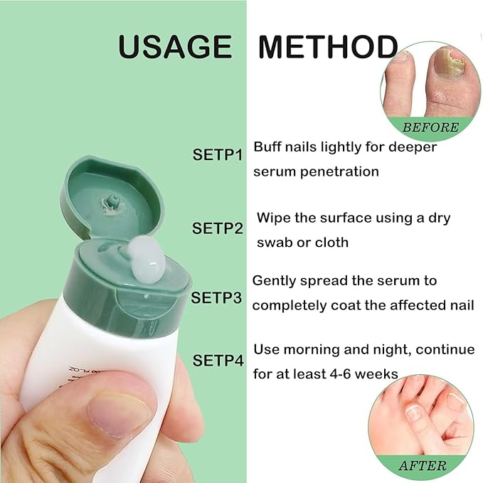 Natural Nail Care Gel, Nutraboost Strengthening Cuticle Serum for Damaged & Brittle Nails, 20ml (1 pcs) (1pcs)