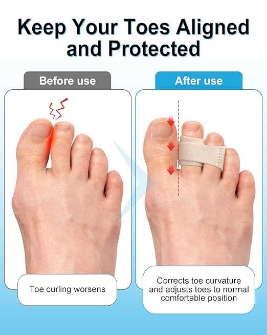 8 Pack Hammer Toe Corrector, Toe Straighteners for Women & Men, Fabric Buddy Wraps for Broken Toes, Hammer Toe Splint for Curled and Bent Toes(skin)