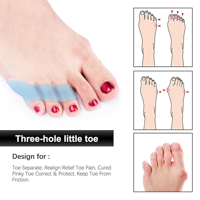 Toe Spacers, 5 Pairs Little Toe Separators Protector with 3 Loops for Curled Toes/Overlapping Toes/Foot Pain/Bunion Corrector and Bunion Relief for Men Women
