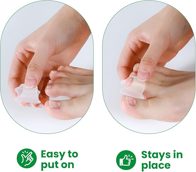 Bukihome Hammertoe Corrector - 6 Pack Toe Straightener to Curled Toes, Broken toe, Bunion Corrector for Women and Men, 3 Different Size (Clear)