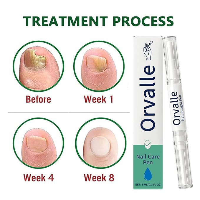 Orvalle Nail Fungus Pen, Nail Growth Treatment Repair Serum Twist Pen Activator for Repair & Strengthener(3PCS)