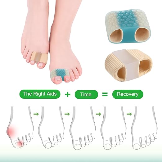 4-Pack SEBS Toe Spacers & Separators for Men & Women – Bunion Relief, Overlapping Toe Correction, Reusable (4 color)