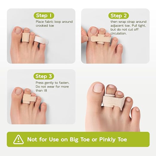 Bukihome Hammertoe Corrector - 10 Pack Toe Straighteners - Broken Toe Wraps - Realign Bent, Curled, Crooked, Claw, Hammer Toes - Toe Corrector Splints for Men and Women (5 Large + 5 Small, Beige)