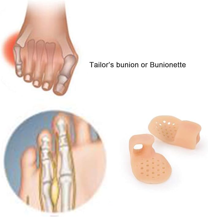 5 Pairs-Pinky Toe Cushion Splint, Gel Toe Separators, Little Toe Straightener with Loop, Pinky Toe Separators for Men Women, Prevent Blisters, Corn, Pain Relief (5 Pairs-Skin)