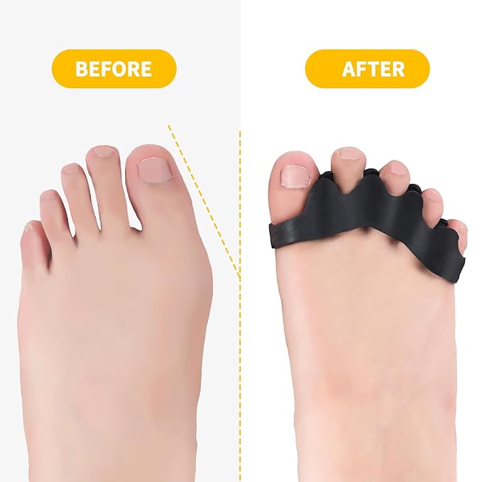 2 Pairs Adjustable Toe Separators for Men and Women, Toe Spacers Improve Balance and Toes to Their Natural Shape, Enhanced Athletic Mobility Applied for Walking, Running, Yoga Practice