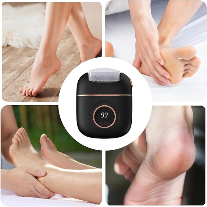 2025 New Electric Callus Remover for Feet, Portable Rechargeable Foot Repair and Grinding Device with Digital Display, Heel Polisher File for Men Women Dry Callus Dead Skin (Yellow)