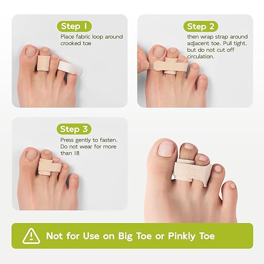 Bukihome Hammertoe Corrector - 10 Pack Toe Straighteners - Broken Toe Wraps - Realign Bent, Curled, Crooked, Claw, Hammer Toes - Toe Corrector Splints for Men and Women (Small, Beige)