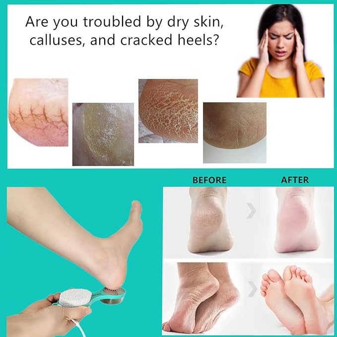 Foot File Callus Remover 5-in-1, 2 Pcs Feet Scraper Pedicure Tools with Pumice Stone, Scrubber Brush, Stainless Steel Foot Rasp and Sand Paper Debris Catcher, Multi Purpose, Pink Cyan