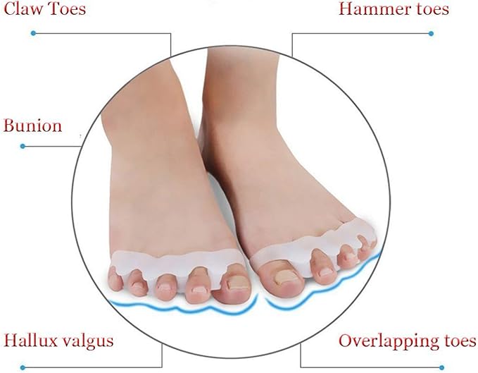 Toe Separators & Spacers,Use for Health & Beauty Pedicures,Plantar Fasciitis, Hammer Toes, Claw Toes & Other Foot Conditions,Pedicures for Men and Women(2 Pcs) - White