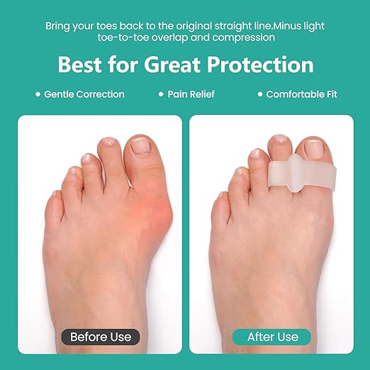 Welnove Pack of 12 Bunion Corrector, Toe Separators with 2 Loops, Big Toe Spacer Suitable for Bunion and Overlap Toe (Clear, Multi Size)