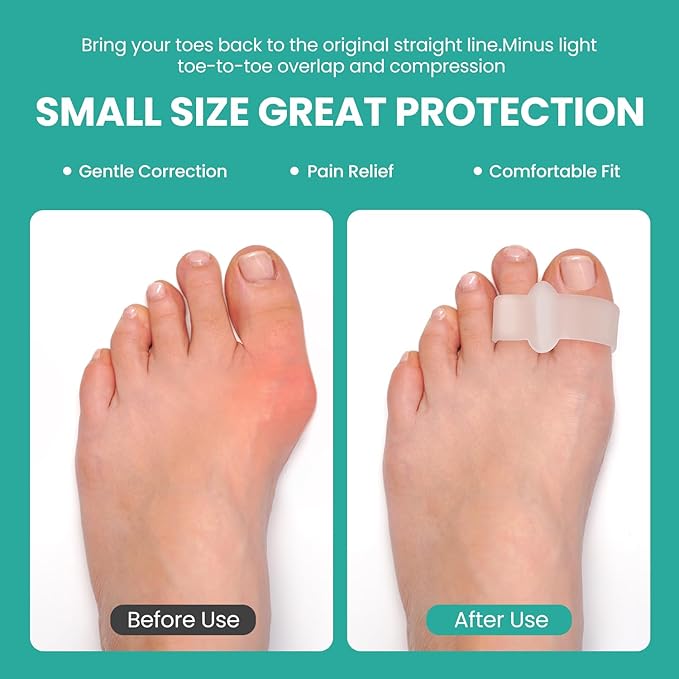 Welnove Pack of 12 Bunion Corrector, Toe Separators with 2 Loops, Big Toe Spacer Suitable for Bunion and Overlap Toe, Infused Aloe Vera Extract (Clear)