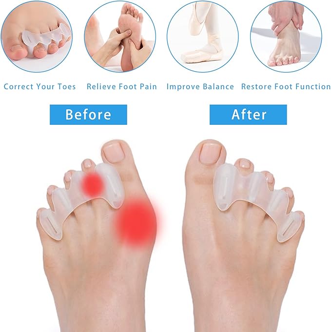 COOLWAVE Toe Separator Toe Spacer for Men and Women, Toe Straightener for Hammer Toes, Bunions, Plantar Fasciitis, Hallux Valgus (1 Pair) (Small)