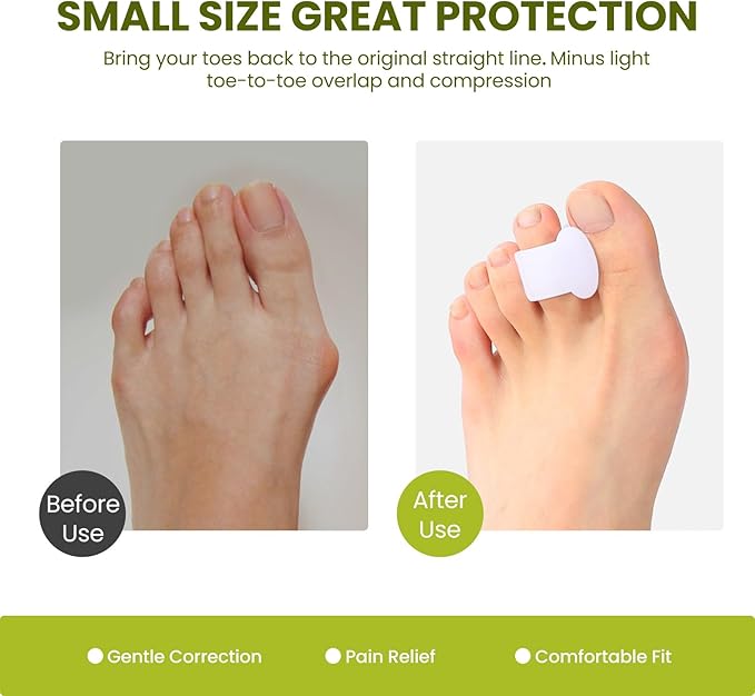 Bukihome Gel Toe Separators for Women -10 Pack Toe Spacers for Overlapping Toes, Bunions, Big Toe Alignment, Bunion Relief - Soft Silicone Toe Corrector for Men (Medium Size)