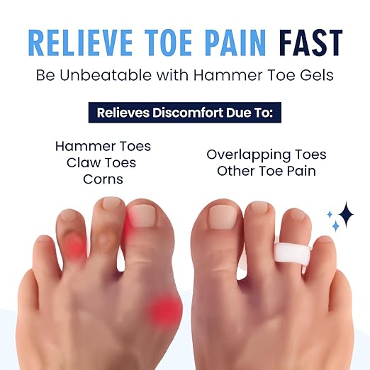 Dr. Frederick's Original Hammer Toe Corrector Gels - 2 Pairs - All-Day Relief for Crooked & Overlapping Toes - Soft Cushioning - Symptomatic Support for Toe Alignment - White - 1 Loop Design